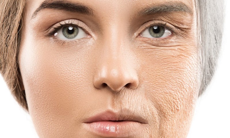 استفاده از کرم ضد آفتاب برای جلوگیری از افتادگی و شل شدگی پوست صورت